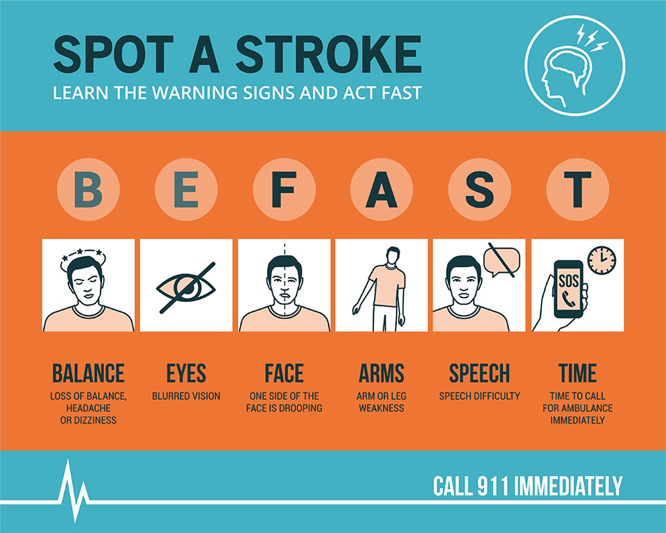 Shay Bennaim-about-Stroke